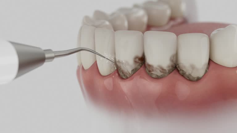 Reliable Dental Implants contractor in Burt, MI by Smile Center Dentistry